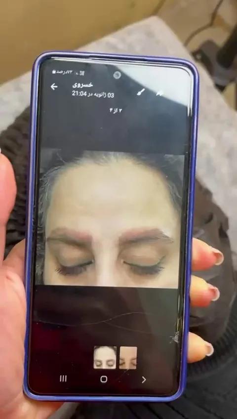 مرکزتخصصی آرایش دائم وریمووفریناز کرباسی