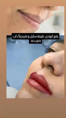 شیدینگ لب