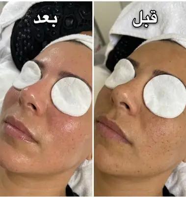 خدمات تخصصی پوست