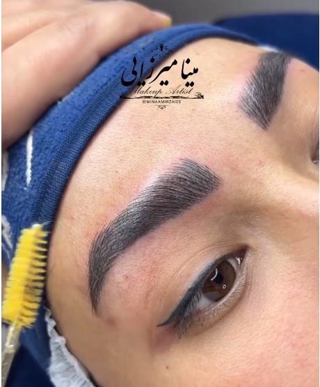 فیبروز ابرو