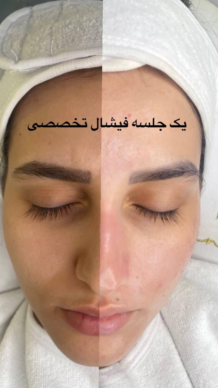 فشیال