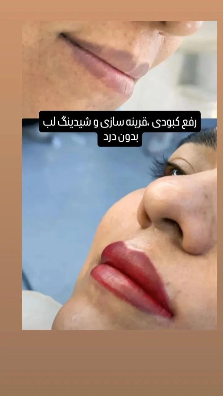 شیدینگ لب
