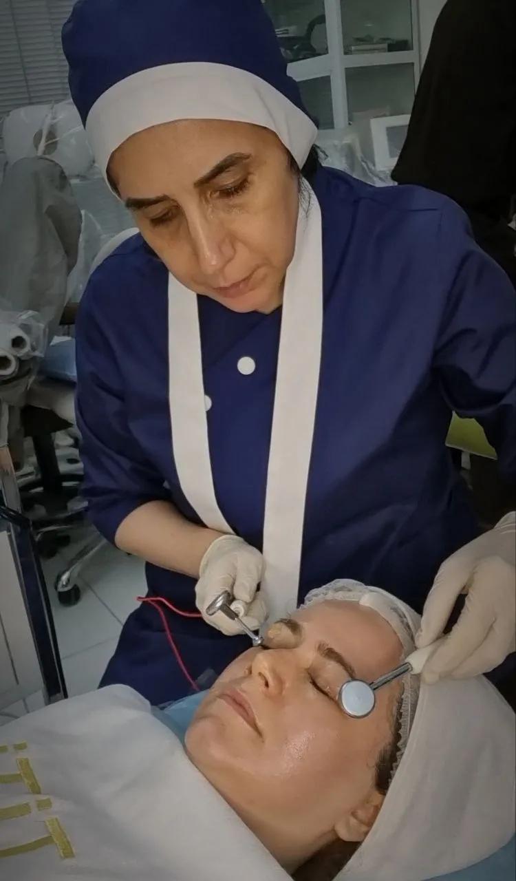 هیدرودرمی