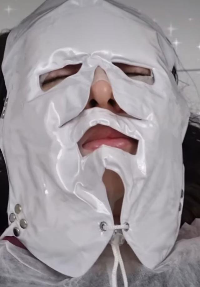473