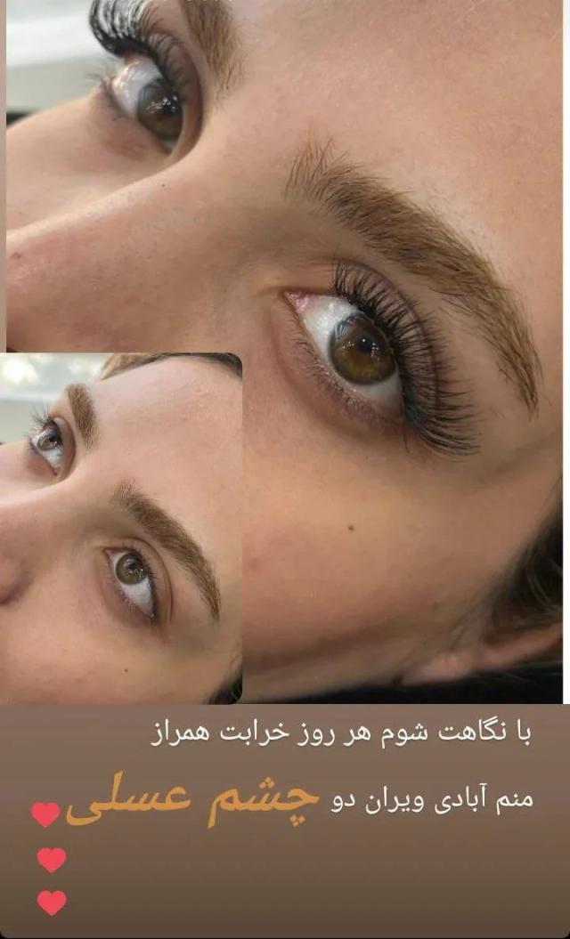 مژه موقت یا کاشت مژه