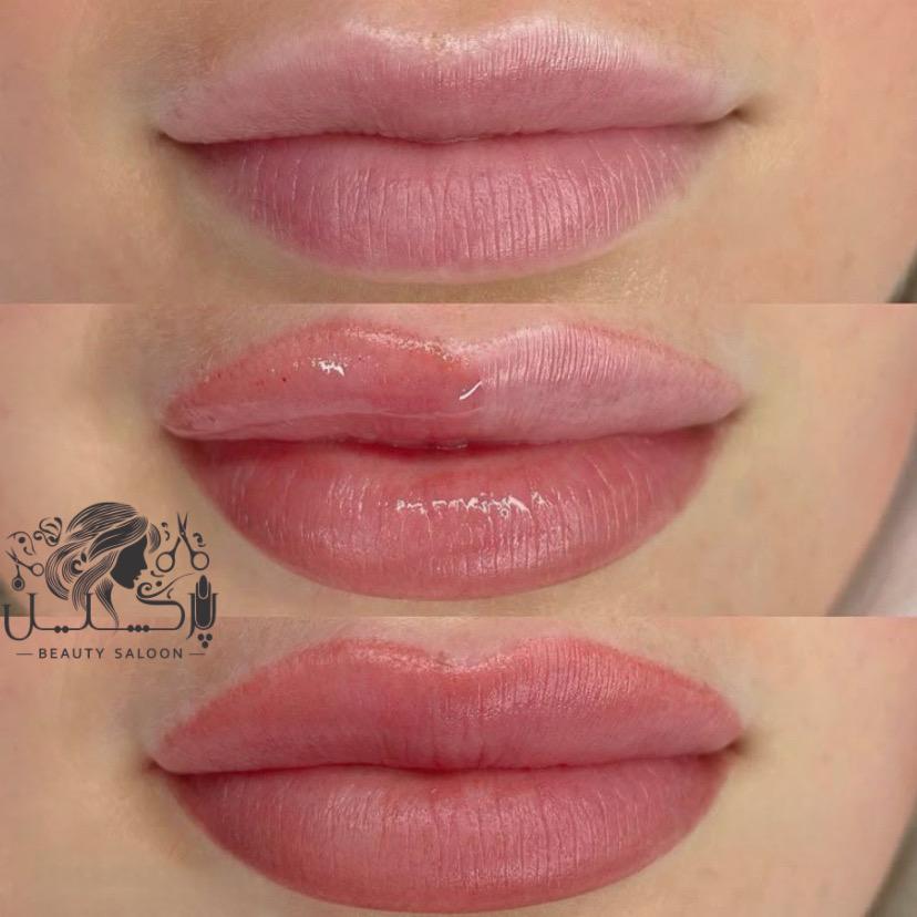 خدمات زیبایی لب