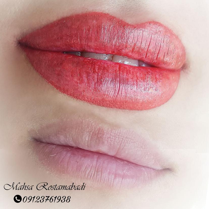 خدمات زیبایی لب