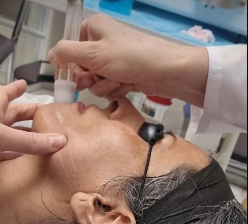 میکرودرم کریستالی